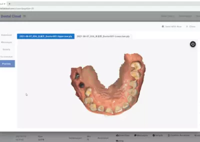 Intraorális szkenner aoralscan