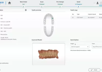 Intraorális szkenner aoralscan