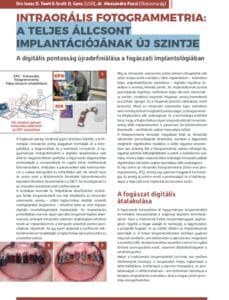 A SHINING 3D Dental lPG technológia validálása