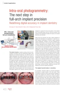 Fogászati CAD CAM eszközök - intraorális szkenner - Aoralscan Elite