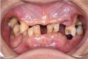 kezelesi-terv-emotion-workstation-1-a