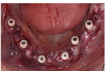 kezelesi-terv-emotion-workstation-1-b