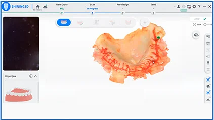 kezelesi-terv-emotion-workstation-2-a