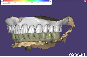 kezelesi-terv-emotion-workstation-3-a