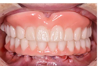 kezelesi-terv-emotion-workstation-3-b eMotion Workstation