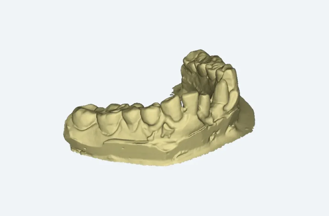 Intelligens kiegészítő szkennelés, AutoScan DS EX Pro