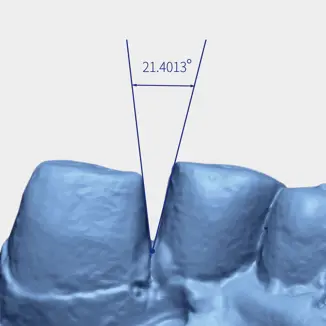 Optimalizált modell szkennelés AutoScan DS EX Pro
