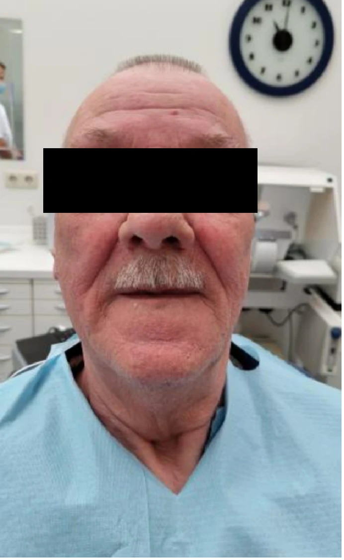 A beteg klinikai képe