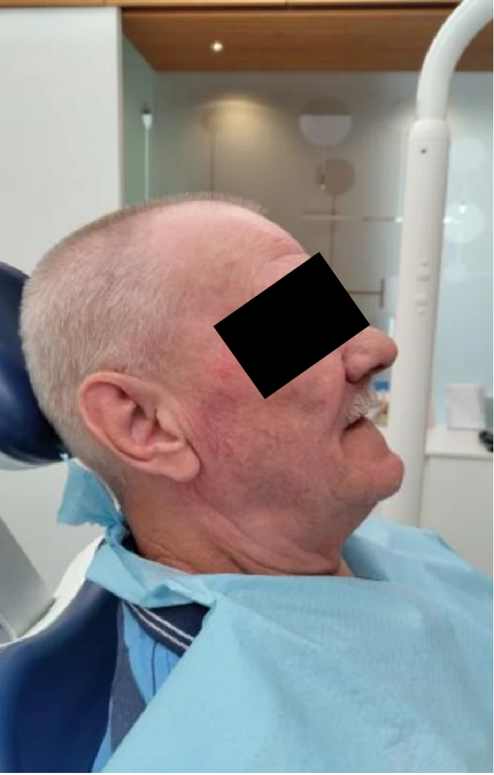 A beteg klinikai képe