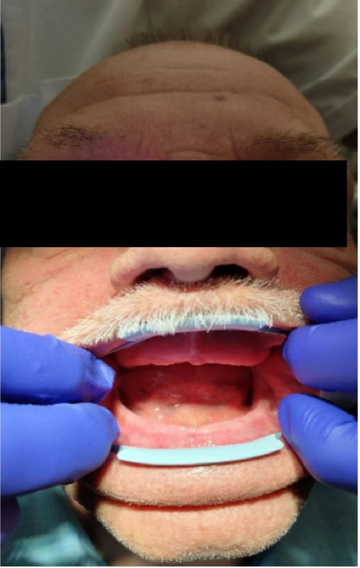 A beteg klinikai képe