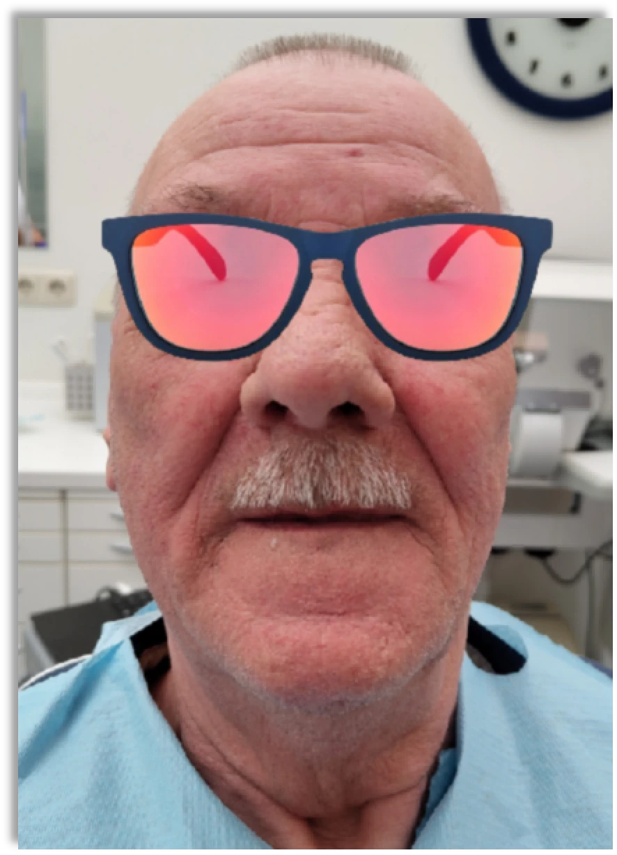 Mart és 3D nyomtatott fogsoralap összehasonlítása