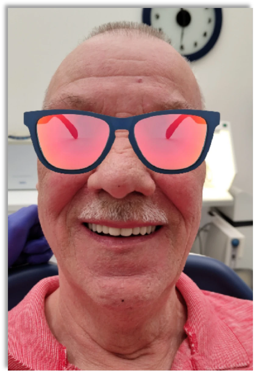 Mart és 3D nyomtatott fogsoralap összehasonlítása