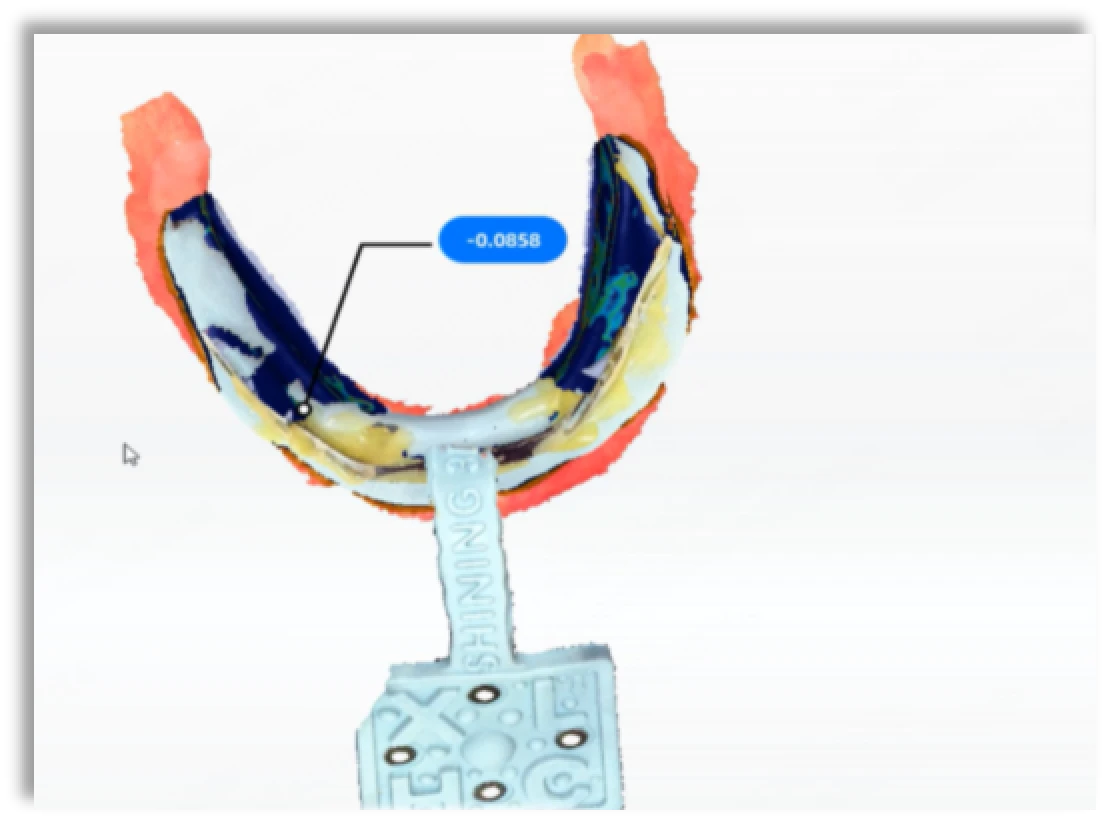 Egyedi tálca szájon kívüli szkennelése Jaw Motion Tracker segítségével