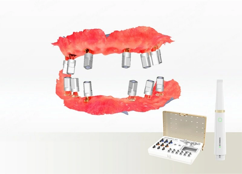 Fogászati fotogrammetria